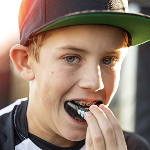 Mouth Guard for Braces, Upper Teeth Protection, Instant Fit I877